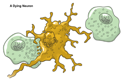 The image of a dying neuron