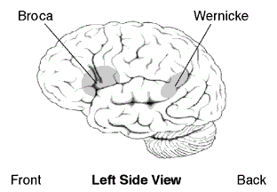 Picture of left side view of brain showing areas affected by Broca's and Wernicke's aphasia.