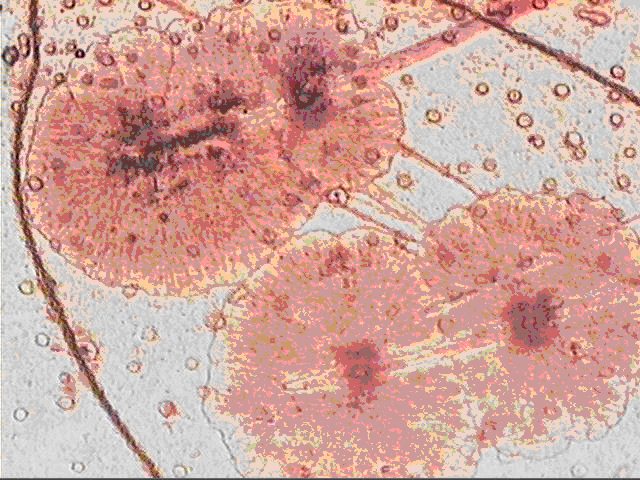 Photomicrograph of white spots on carapace (x 100).