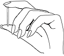 A drawing of a woman's hand holding an implantable rod
