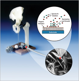 This micrograph of the antimicrobial thin-film coating, along with a schematic, shows the process for depositing the coating on a medical device that significantly reduces the risk of dangerous infections.