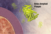 Beta-amyloid plaque