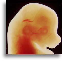 Craniofacial Region of Mouse Embryo