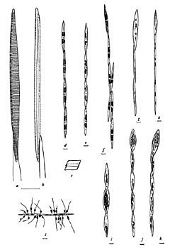 These intricate line drawings of pseudo-nitzschia are from a book published in 1943! 