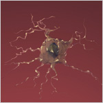 Image of dying neuron