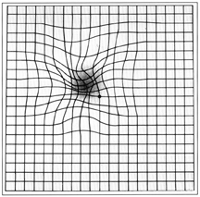 Así es como una persona con degeneración macular relacionada con la edad puede ver la rejilla de Amsler.