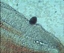 Figure 1. Microscopic view of Trophont