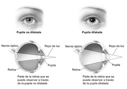 Diagrama del ojo: Antes y después de dilatar la pupila