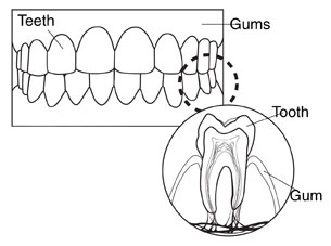 Drawing of teeth, gums, and a single tooth. One part of the drawing is labeled to show teeth and gums. Another part of the drawing is labeled to show a cross-section of a tooth and the gum.
