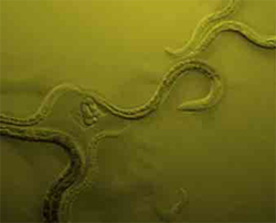 Caenorhabditis elegans: Roundworm