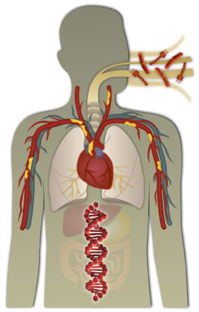 human figure inhaling a faintly colored gas, some bacteria and lipopolysaccharide to connote that genetic polymorphsism interact with environment.