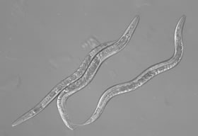 Micrograph of the free-living nematode, Caenorhabditis elegans. (Picture by Wendy Boyd, Duke University)