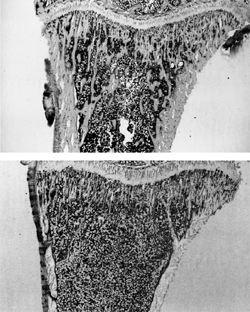 bone density comparison