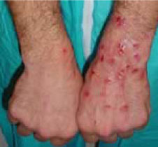 Photo of a Meth Hands