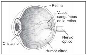 Imagen mostrando las partes del ojo que son: el cristalino, la retina, los vasos sanguíneos de la lente, el nervio óptico, y el vítreo