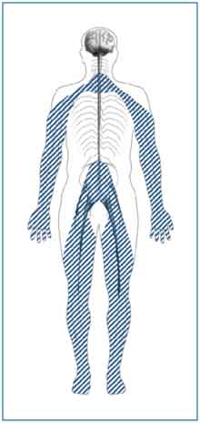 Outline of a body with shaded lines showing the location of nerves affected by peripheral neuropathy. Peripheral nerves are in the toes, feet, legs, hands, and arms.