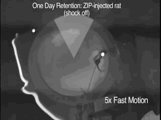 one day retention ZIP injected rat (shock off)