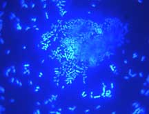 highly magnified photograph showing psychrophile stained fluorescent blue
