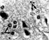 Cells from patient with hepatic encephalopathy