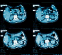 Image is example of results from a CT scanning proceedure