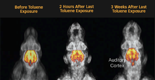 REPEATED TOLUENE EXPOSURE DEPRESSES BRAIN ACTIVITY - microPet Image