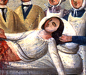 Close up of a woman undergoing surgery, 1914, oil on tin.  From the Chiesa dell'ospedale Santa Marta (Church of the hospital of Saint Martha), Catania, Sicily.  Courtesy Giuseppe Maimone Editore, Catania and Mario Alberghina.