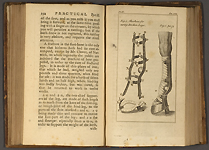 Practical farriery, or, The complete directory : in whatever relates to the food, management, and cure of the diseases incident to horses ; the whole alphabetically digested, and illustrated with copper-plates, page 154 and plate II