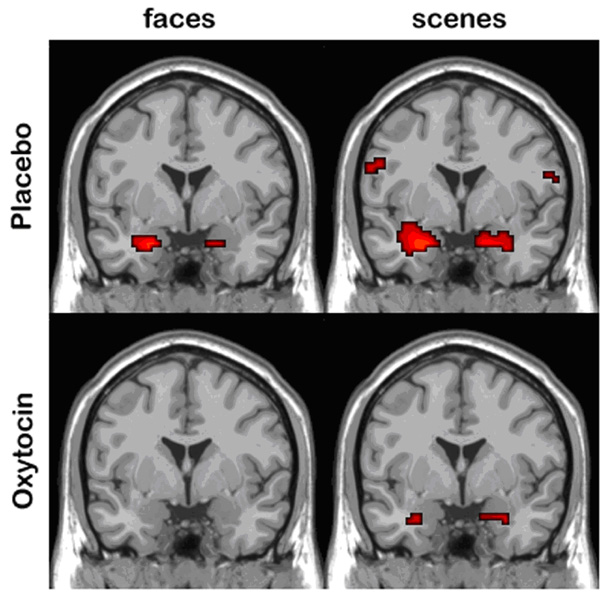 fMRI showing oxytocin reduces amygdala activity