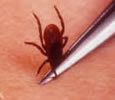 Removing a Tick.