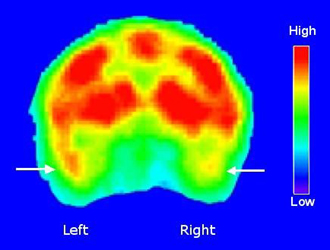 Image of monkey brain scan