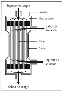 Ilustración de un dializador de fibra hueca común.