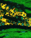 an image of human-derived heart muscle cells (yellow) thriving alongside normal heart muscle cells in a rat heart