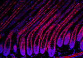 Photo of Dlx3/lacZ expression in Hair.