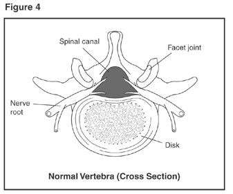 Normal Vertebra (cross section)