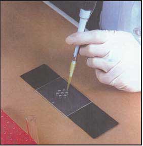Photograph of the gloved hand of a scientist performing serological testing