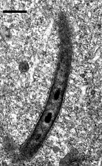 micrograph of polynucleobacter