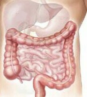 HealthDay news image for article titled: Colon Cancer Treatments Need Improvements