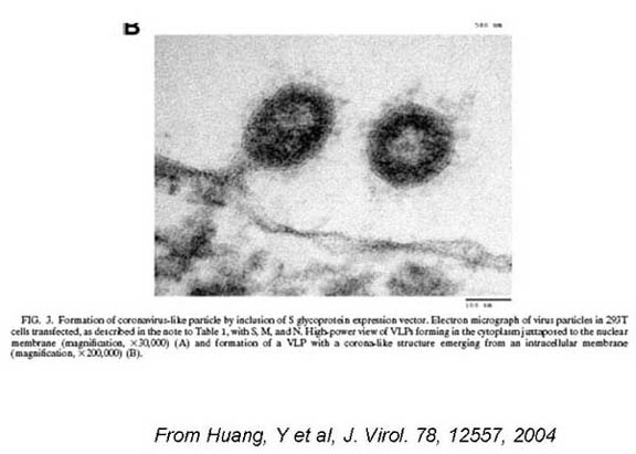 Picture of SARS virus as well as reference of From Huang, y et al, J. Virol 78, 12557, 2004