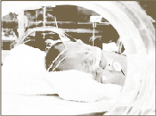 premature baby in an incubator