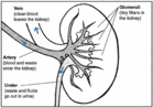 A diagram of a kidney - Click to enlarge in new window.