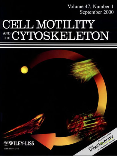 Photo of cover illustration, Cell Motility and the Cytoskeleton (volume 47, number 1, 2000).