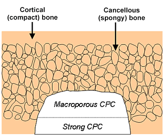 schematic of cortical and cacellous bone