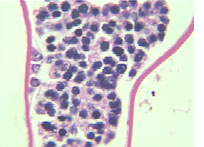 Microscope photo of crab tissue sample showing heavy infestation of Hematodinium parasite.