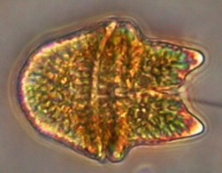 Microscopic view of a phytoplankton cell (Akashiwo sanguinea) collected during the September 2004 algal bloom in San Francisco Bay, California