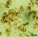 immunocytochemical staining of somatropes