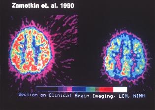 [ Brain Scan Images ]