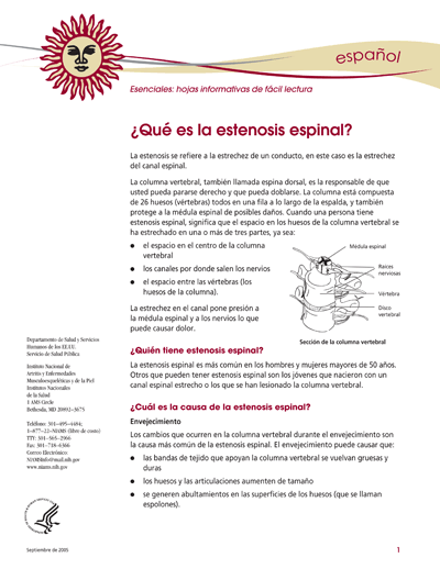 Estenosis Espinal: Esenciales: hojas informativas de fácil lectura cover