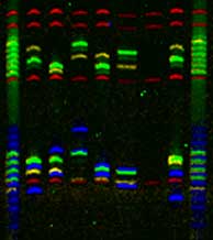 Columns of a DNA gel show the sizes of Y chromosome fragments from 6 male and 1 female sample (empty lane third from right)