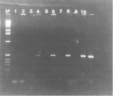 Photograph showing detection of
HAV sequence in RNA isolated from clam tissue seeded with wild-type HAV.