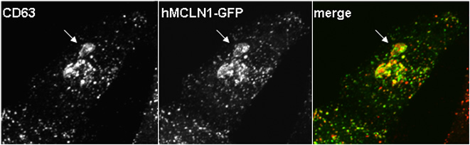 hMCLN1-GFP in HeLa cells